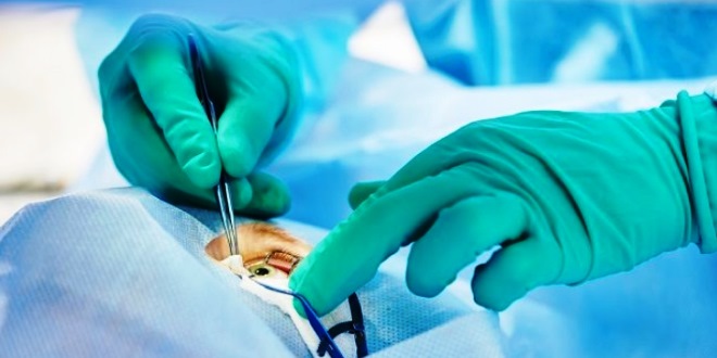Mengenal Operasi LASIK, Solusi Canggih untuk Mata Minus yang Bikin Hidup Lebih Simpel dan Nyaman